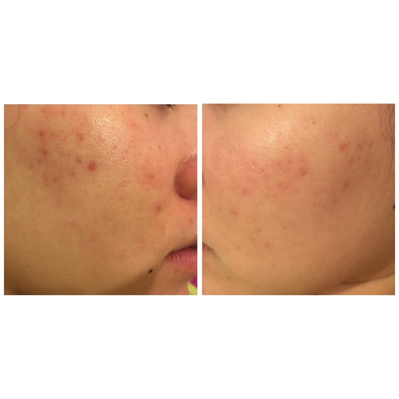 Avene Cicalfate Repair Cream (for Sensitive & Irrita Skin) 100ml