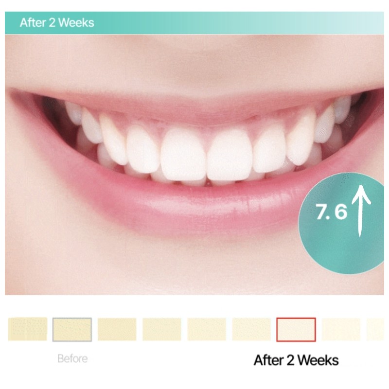 LIVE ORALS Puredia Whitening Gel 10g (For 2weeks)