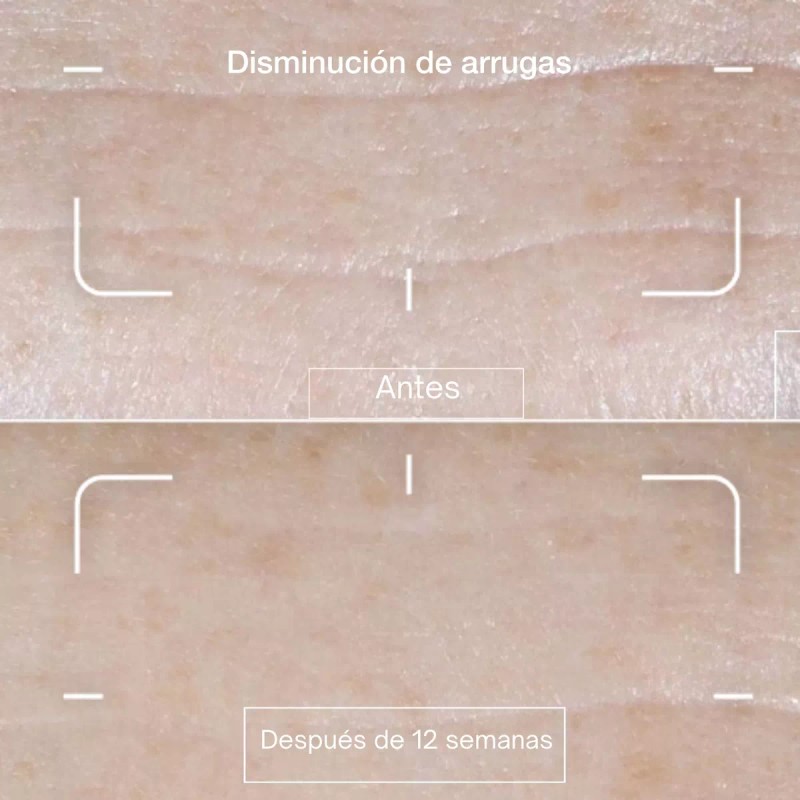 Biotiks Crema Facial Antiedad Con Ácido Hialurónico Y Rosa Mosqueta