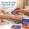Gel Quemaduras Burnfix Por Sobre Crema Hidrogel Calmante Una Sensación