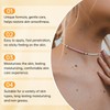 FIYADWZH Fast-Acting Bee Venom Cream,Natural Bee Venom Cream,Face Cream Moisturiser,for