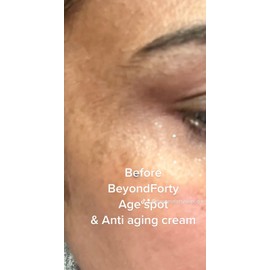 BeyondForty Skin Care Anti Aging And Age Spot Cream