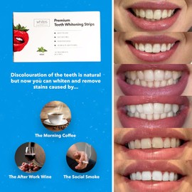 Whites Beaconsfield Teeth Whitening Strips – 14-Day Non-Peroxide Formula, Enamel-Safe & Gentle for Sensitive Teeth