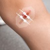 Emergency Wound Closure Strip 2PCS Wound Closure Kit Zip Stitch