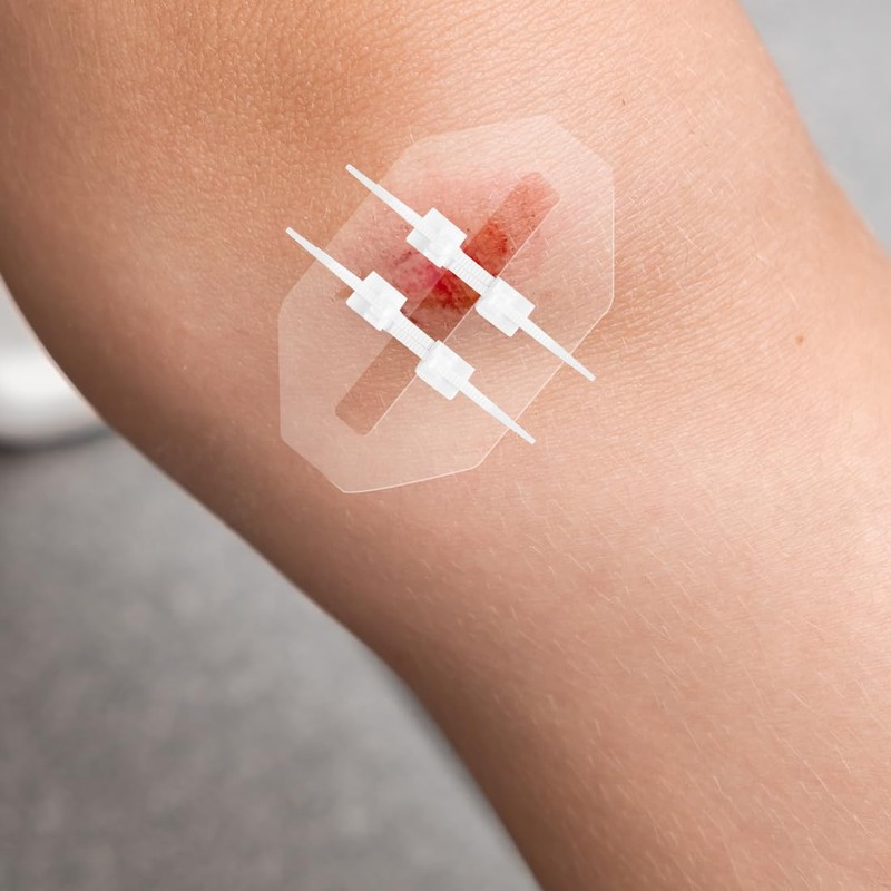 Emergency Wound Closure Strip 2PCS Wound Closure Kit Zip Stitch