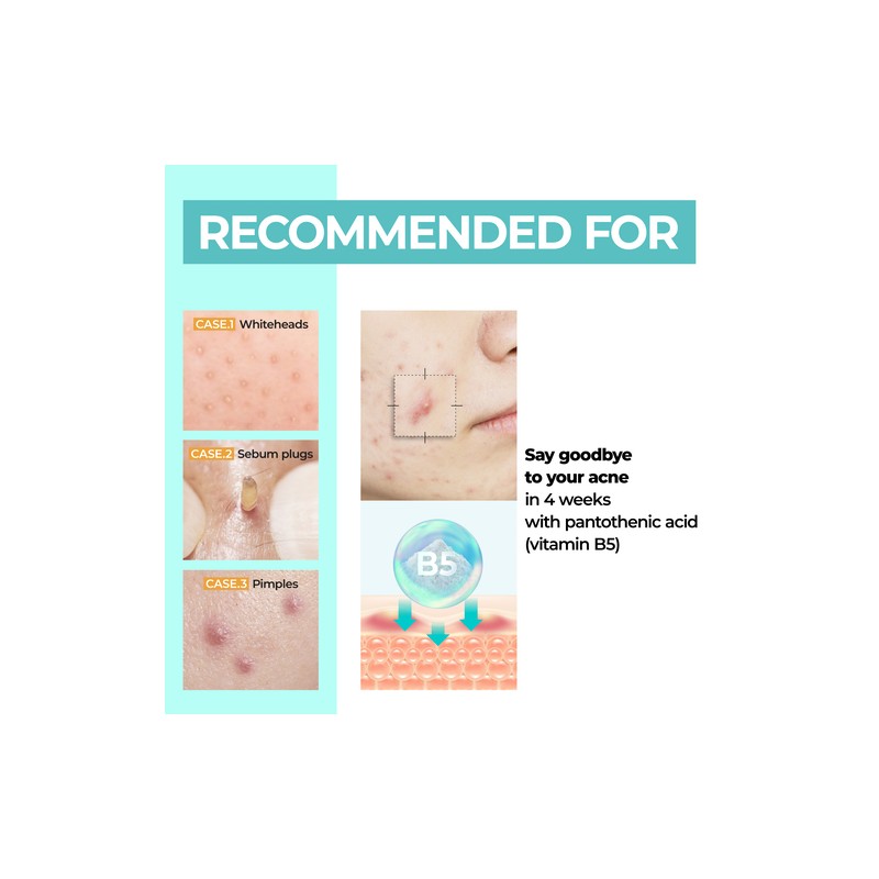 Numbuzin [Numbuzin]No.1 Pantothenic B5 Active Soothing Cream 80ml