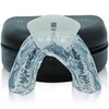 Custom Molded Night Mouth Guard - Designed by Tranquillam Sleep