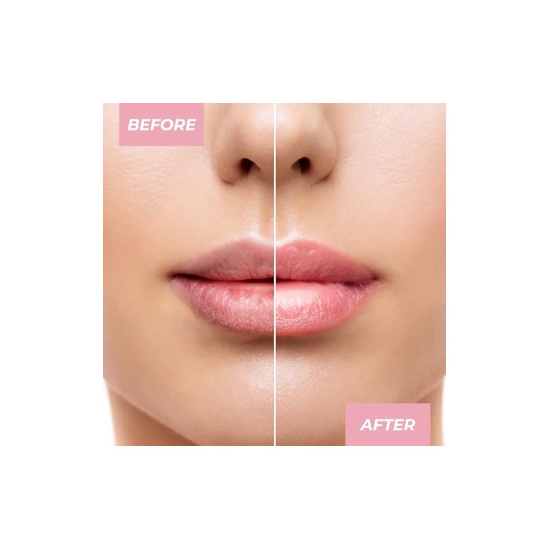 MCoBeauty Bálsamo Labial Glow Up Ph - Cuidado Labial Universal