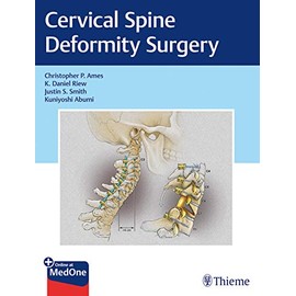 Cervical Spine Deformity Surgery