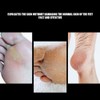 Stainless Steel Foot Nail Drill Bit Pedicure Foot Calluses Sanding