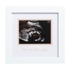 Pearhead Love At First Sight Sonogram Frame, Ultrasound Picture Frame,