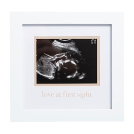 Pearhead Love At First Sight Sonogram Frame, Ultrasound Picture Frame, Pregnancy Announcement Photo Frame, Baby Keepsake Gift For Expecting Parents