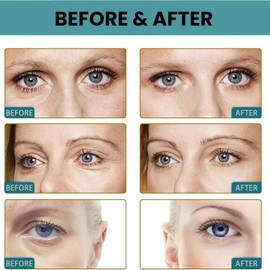 15ML Sagging Eyelids Cream,Eye Bags Dark Circles Treatment Cream,Instant Wrinkle Corrector Ey/elids C/ream,Nat/ural Face Eyel/id Cr/eam,Upper Eye Lift Effect Application