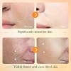 Sérum Facial Con Vitamina C, Antioxidante, Brillo, Antiacné,