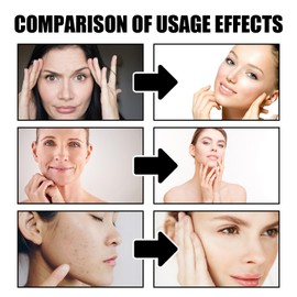 Straffende Creme Für Das Gesicht + Anti Falten Gesichtsserum, Drachenblut Creme, Drachenblut Serum, Feuchtigkeitsspendendes Drachenblut Serum, Nourishing Rejuvenating Cream (30ml+50g)