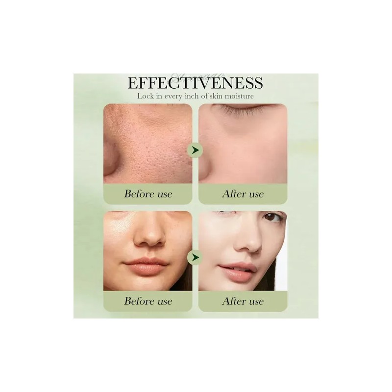 Kit Skincare Aguacate 7pz Tonico Suero Limpiador Balsamo Loc