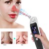 USB Electric Blackheads Removal Vacuum Face Pores Cleaner Exfoliating Lifting