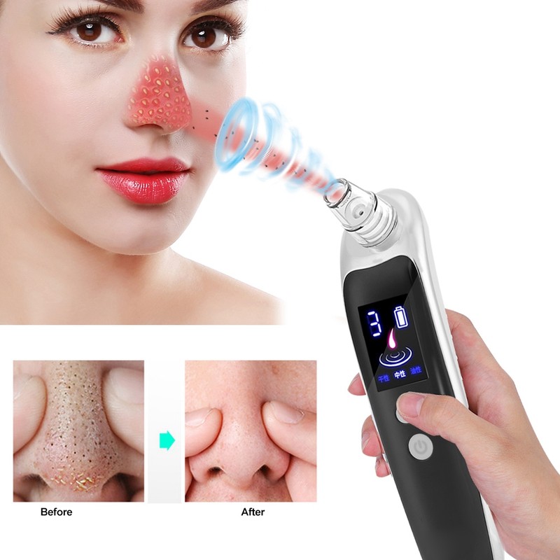 USB Electric Blackheads Removal Vacuum Face Pores Cleaner Exfoliating Lifting