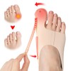 flintronic Hallux Valgus Correction, 2 Pieces Toe Separator, Hallux Valgus