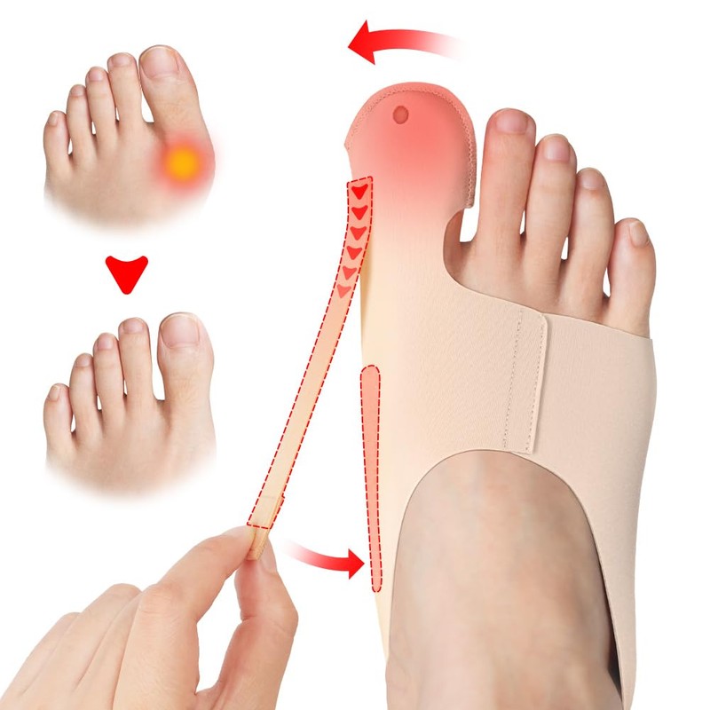 flintronic Hallux Valgus Correction, 2 Pieces Toe Separator, Hallux Valgus