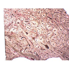 EISCO 10pk Compact Bone (Ground), Prepared Microscope Slides - 75 x 25mm Classroom Pack, 10 in Storage Case Anatomy, Biology & Microscopy- Eisco Labs