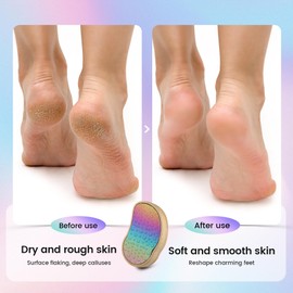BEZOX Stainless Steel Pedi Egg Foot File Callus Remover for Dry and Wet Feet, Smooth Rough Skin, Plastic-Free Pedicure Tool Pumice Stone, Washable Foot Scrubber for Cracked Heels - Rainbow