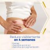 Crema Corporal Anti-manchas Y Estrías Luminous 200ml Nivea