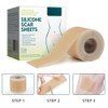 3 Meters Silicone Scar Stickers to Reduce Itching and Redness
