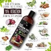 Generic Organic Onion Hair Growth Oil | Controls Hair Loss,