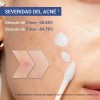 Dr.leo Serum Ácido Salicílico 1.8% Para Acné | Loción 20