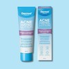 Dermal Therapy Acne Control Lotion 85ml
