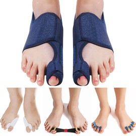 Hallux Valgus Toe Corrector Toe Separator Bunion Splint 【2025 Updated】 Bunion Corrector Kit Bunion Corrector Set Bunion Brace Bunion Exercise Belt Orthopedic Kit Inflamed