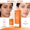 Turmeric Kojic Acid Cleansing Pads for Face – 40 Exfoliating