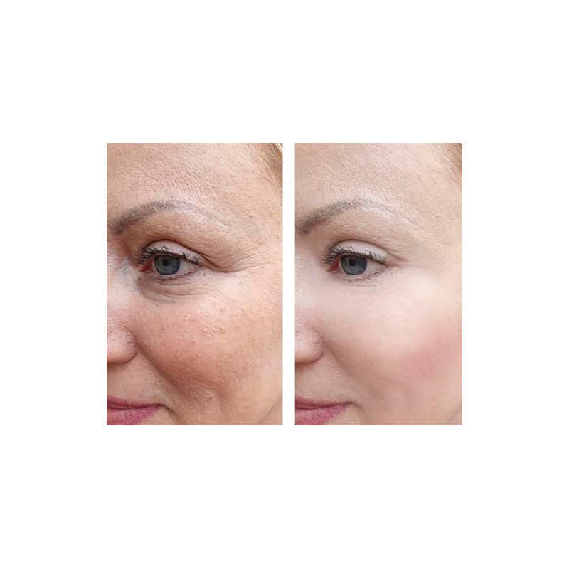 Vitality Precision Skin Phloretin C Serum