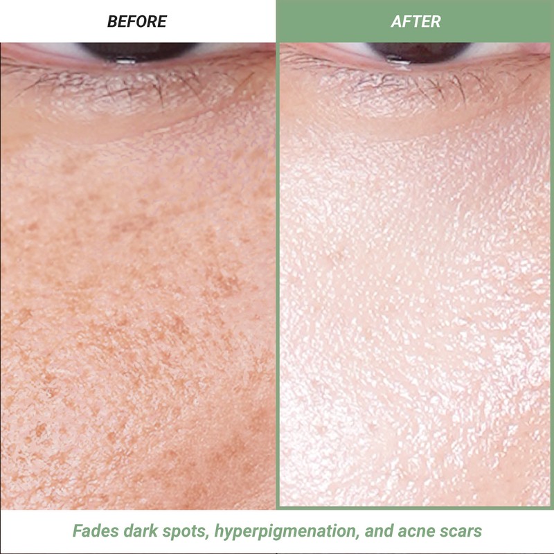 Meebak Cica & Vitamin C Serum 33ml - Meebak Cica