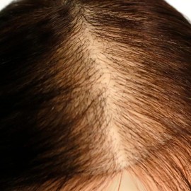 HAIR MESH INTEGRATION hair loss training Mannequin head | 100% Human Hair training head for salons, training, academy