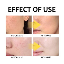 30PCS Turmeric Kojic Acid Cleansing Pads,Turmeric Face Scrub Pads,Cleansing Pads for Exfoliation,Face Pads Cleansing Cotton,Helps Balance Skin Oil and Water,Refreshes Controls Oil,Refines Pores