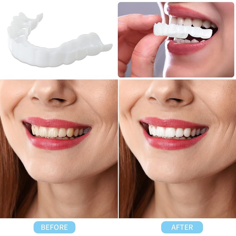 Clip-On Teeth, 2 Pairs of Veneers Dentures Top and Bottom,
