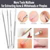 YMCCOOL Blackhead Remover Tool Kit,12Pcs Pimple Popper Comedone Extractor Tool