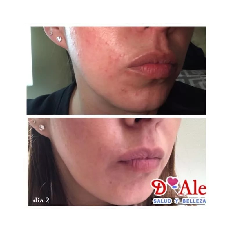 D'Ale 2 Cremas Facial Regeneradora Células Madre, Hidratante, Fps