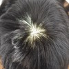 Healthlif Toupee for Men Hairpiece Hairpieces And Toupees Thin Skin