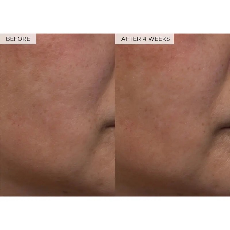 Glow Recipe Watermelon Glow Tónico Exfoliante PHA BHA Vegano 40ml