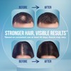 Dr. Cinik Caffeine Shampoo for Hair Growth Strengthening Keratin Shampoo