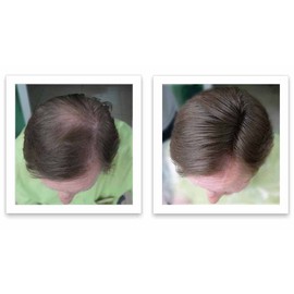 Caboki Hair Loss Concealer Trial Pack (Light Brown)