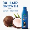 Parachute Advansed coconut Hair Oil, 175ml - 1 Pack (Ship