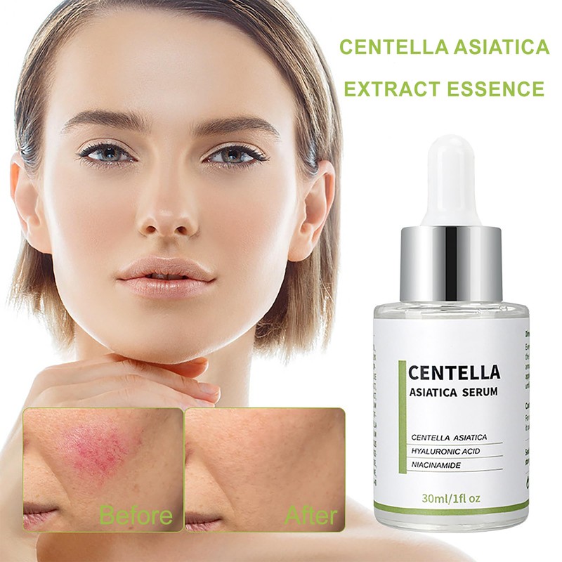 Centella Asiatica Serum,Facial Soothing Redness Serum|For Sensitive Skin-Including Chamomile Extract,