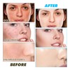 Kojic Acid and Turmeric Cleansing Pads - 60pcs Brightening and