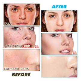 Kojic Acid and Turmeric Cleansing Pads - 60pcs Brightening and Exfoliating Pads for Smooth, Radiant Skin