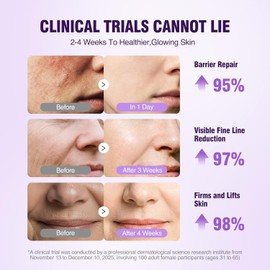 Retinol Peptide Serum for Face: Anti-Aging Collagen NAD+ Hydration Serum for Wrinkles Fine Lines Women Men Weekly Balm Face Neck Skin Tightening Size / 얼굴용 레티놀 펩타이드 세럼: 주름 잔주름을 위한 항노화 콜라겐 NAD+ 하이드레이션 세럼 여성 남성 주간 밤을 얼굴 목 피부 강화 Size