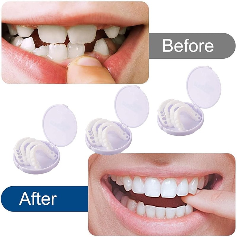 Fake Teeth 6 Pairs False Artificial Temporary Teeth Braces Smile
